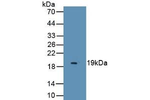 Detection of Recombinant ESM1, Human using Monoclonal Antibody to Endothelial Cell Specific Molecule 1 (ESM1)