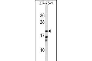CBR4 Antibody (C-term) (ABIN1536794 and ABIN2849112) western blot analysis in ZR-75-1 cell line lysates (35 μg/lane). (CBR4 抗体  (C-Term))