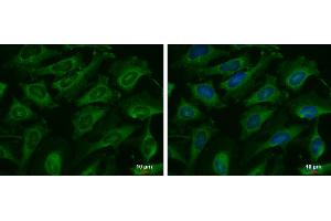 ICC/IF Image C9orf98 antibody [N3C3] detects C9orf98 protein at cytoplasm by immunofluorescent analysis. (AK8 抗体)