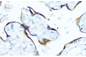 Immunohistochemistry of paraffin-embedded Human placenta using Aromatase Polyclonal Antibody at dilution of 1:100 (40x lens). (Aromatase 抗体)