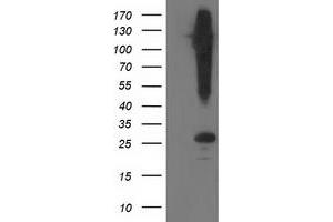 Western Blotting (WB) image for anti-Synaptosomal-Associated Protein, 25kDa (SNAP25) antibody (ABIN1501016)