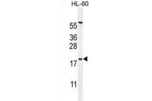 Western Blotting (WB) image for anti-Developmental Pluripotency Associated 5 (DPPA5) antibody (ABIN2996143) (DPPA5 抗体)