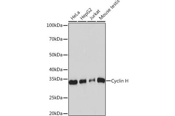 Cyclin H 抗体
