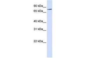 Image no. 1 for anti-Receptor-Interacting Serine-threonine Kinase 4 (RIPK4) (C-Term) antibody (ABIN6740940) (RIPK4 抗体  (C-Term))