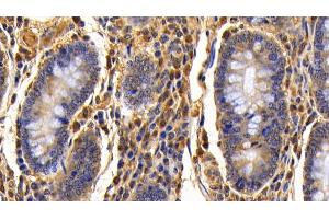 Detection of TNFa in Bovine Colon Tissue using Polyclonal Antibody to Tumor Necrosis Factor Alpha (TNFa)