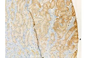 ABIN7094514 and ABIN7098563 at 1/100 staining Rat kidney tissue by IHC-P. (PDE4A 抗体  (C-Term))