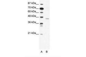 Image no. 1 for anti-2',3'-Cyclic Nucleotide 3' phosphodiesterase (CNP) (AA 86-135) antibody (ABIN202430) (Cnpase 抗体  (AA 86-135))