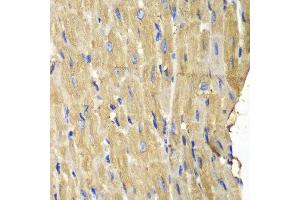 Immunohistochemistry of paraffin-embedded mouse heart using PLCG2 antibody at dilution of 1:100 (400x lens). (Phospholipase C gamma 2 抗体)