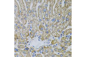 Immunohistochemistry of paraffin-embedded human liver injury using EPO antibody (ABIN5973306) (40x lens).