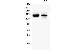 Western blot analysis of TEK using anti-TEK antibody (ABIN7600762). (TEK 抗体  (AA 23-616))