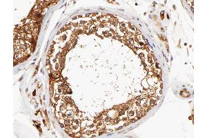 ABIN6266784 at 1/100 staining human testis tissue sections by IHC-P. (DCLK3 抗体)