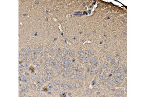 IHC analysis of SRP72 using anti-SRP72 antibody (ABIN7601648). (SRP72 抗体  (AA 40-460))