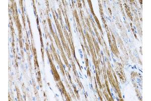 Immunohistochemistry (Paraffin-embedded Sections) (IHC (p)) image for anti-Actin, beta (ACTB) antibody (ABIN3020544)
