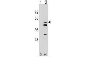 Western blot analysis of FDPS (arrow) using rabbit polyclonal FDPS Antibody (N-term) . (FDPS 抗体  (N-Term))