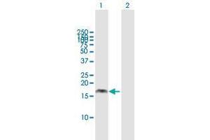 Western Blot analysis of PMAIP1 expression in transfected 293T cell line by PMAIP1 MaxPab polyclonal antibody. (NOXA 抗体  (AA 1-136))