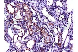 Formalin-fixed and paraffin embedded rat kidney tissue labeled with Anti-SCF Polyclonal Antibody (ABIN669936), Unconjugated at 1:200, followed by conjugation to the secondary antibody and DAB staining (KIT Ligand 抗体  (AA 151-250))