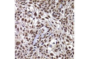Immunohistochemistry (Paraffin-embedded Sections) (IHC (p)) image for anti-DnaJ (Hsp40) Homolog, Subfamily B, Member 6 (DNAJB6) (AA 177-326) antibody (ABIN6139713)