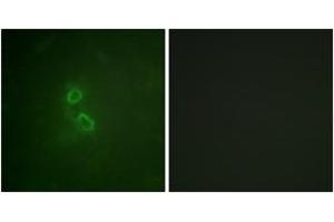 Immunofluorescence analysis of COS7 cells, using CD227/MUC1 (Ab-1229) Antibody. (MUC1 抗体  (AA 1201-1250))