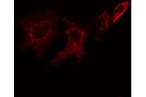 ABIN6266883 staining HeLa cells by IF/ICC.