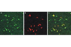 Immunohistochemistry (IHC) image for anti-Calbindin (CALB1) (AA 3-251) antibody (ABIN1742425) (CALB1 抗体  (AA 3-251))