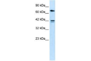 CACNB1 antibody used at 1 ug/ml to detect target protein. (CACNB1 抗体  (N-Term))