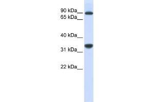WB Suggested Anti-RRP1B  Antibody Titration: 0. (RRP1B 抗体  (Middle Region))
