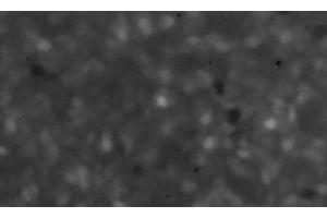 Image of the maximum plot of the fluorescence intensity (F/F0) of a Fluo3-stained culture of SiMa human neuroblastoma cells pretreated for 12 h with 10 μg/ml of α-CJe, and subsequently perfused for 50 s with 10 nmol/l of ACh in standard bath solution. (Campylobacter jejuni 抗体)