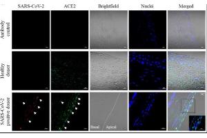 Immunostaining (ISt) image for anti-Angiotensin I Converting Enzyme 2 (ACE2) antibody (ABIN1169449)