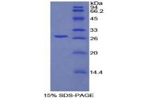 SDS-PAGE analysis of Rat Spondin 2 Protein. (SPON2 蛋白)
