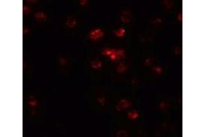 Immunofluorescence of TSHZ2 in A20 cells with TSHZ2 antibody at 20 µg/ml. (TSHZ2 抗体  (N-Term))