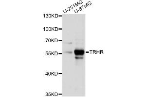 Western blot analysis of extracts of various cell lines, using TRHR antibody (ABIN6292313) at 1:1000 dilution. (TRHR 抗体)