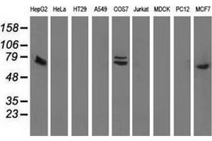 Western blot analysis of extracts (35 µg) from 9 different cell lines by using anti-SAMHD1 monoclonal antibody. (SAMHD1 抗体)