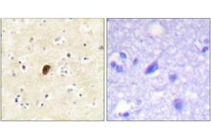 Immunohistochemistry analysis of paraffin-embedded human brain, using GluR4 (Phospho-Ser862) Antibody. (GRIA4 抗体  (pSer862))