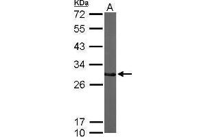Western Blotting (WB) image for anti-CTD (Carboxy-terminal Domain, RNA Polymerase II, Polypeptide A) Small Phosphatase 2 (CTDSP2) (Center) antibody (ABIN2855986)