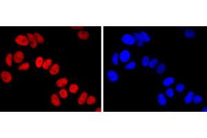 MCF-7 cells were stained with FOXA1 (5F7) Monoclonal Antibody  at 1:200 dilution, incubated overnight at 4C, followed by secondary antibody incubation, DAPI staining of the nuclei and detection. (FOXA1 抗体)