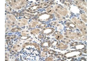 Presenilin 2 antibody was used for immunohistochemistry at a concentration of 4-8 ug/ml to stain Epithelial cells of renal tubule (arrows) in Human Kidney. (Presenilin 2 抗体)