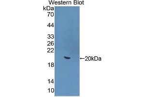 Detection of Recombinant IL22, Mouse using Polyclonal Antibody to Interleukin 22 (IL22) (IL-22 抗体  (AA 34-179))