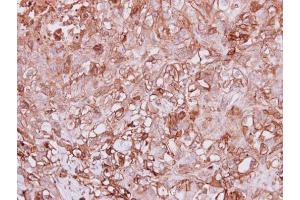 IHC-P Image Immunohistochemical analysis of paraffin-embedded DU145 xenograft, using Angiopoietin 4, antibody at 1:100 dilution. (Angiopoietin 4 抗体  (N-Term))