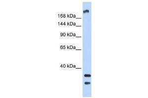 Western Blot showing TRPM2 antibody used at a concentration of 1 ug/ml against Fetal Brain Lysate