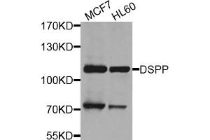 Western blot analysis of extracts of various cell lines, using DSPP antibody.