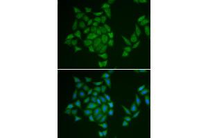 Immunofluorescence analysis of HeLa cells using AMPD3 antibody (ABIN6290008). (AMPD3 抗体)