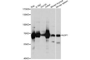 Western blot analysis of extracts of various cell lines, using LCP1 antibody (ABIN1876741) at 1:1000 dilution. (LCP1 抗体)