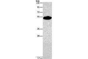 Western blot analysis of Mouse heart tissue, using SMAD9 Polyclonal Antibody at dilution of 1:290 (SMAD9 抗体)