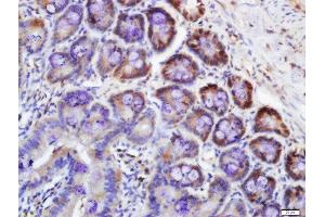 Formalin-fixed and paraffin embedded rat colon labeled with Rabbit Anti-RNF122 Polyclonal Antibody, Unconjugated  at 1:200 followed by conjugation to the secondary antibody and DAB staining (RNF122 抗体  (AA 71-155))
