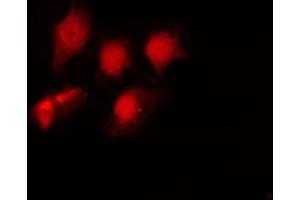 ABIN6267694 staining NIH-3T3 by IF/ICC. (HDAC6 抗体  (pSer22))
