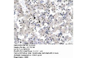 Human Liver (ZNF654 抗体  (Middle Region))