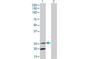 Western Blot analysis of IL6 expression in transfected 293T cell line by IL6 monoclonal antibody (M04), clone 3G6. (IL-6 抗体  (AA 29-212))