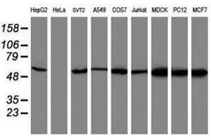 Image no. 1 for anti-V-Akt Murine Thymoma Viral Oncogene Homolog 1 (AKT1) antibody (ABIN1496557) (AKT1 抗体)