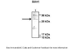 Lanes:   Lane1: 50 ug human HEK-293T lysate  Primary Antibody Dilution:   1:1000  Secondary Antibody:   Anti-rabbit-IgG  Secondary Antibody Dilution:   1:5000  Gene Name:   SIAH1  Submitted by:   Peter Brand & Dr. (SIAH1 抗体  (C-Term))