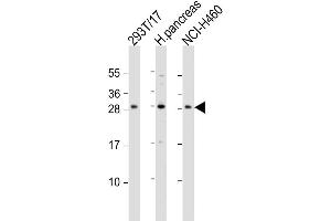 Western Blot at 1:1000 dilution Lane 1: 293T/17 whole cell lysate Lane 2: human pancreas lysate Lane 3: NCI-H460 whole cell lysate Lysates/proteins at 20 ug per lane. (COMTD1 抗体  (C-Term))